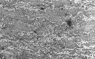 Micrograph of Plasma Spray Tungsten Carbide/12% Cobalt
